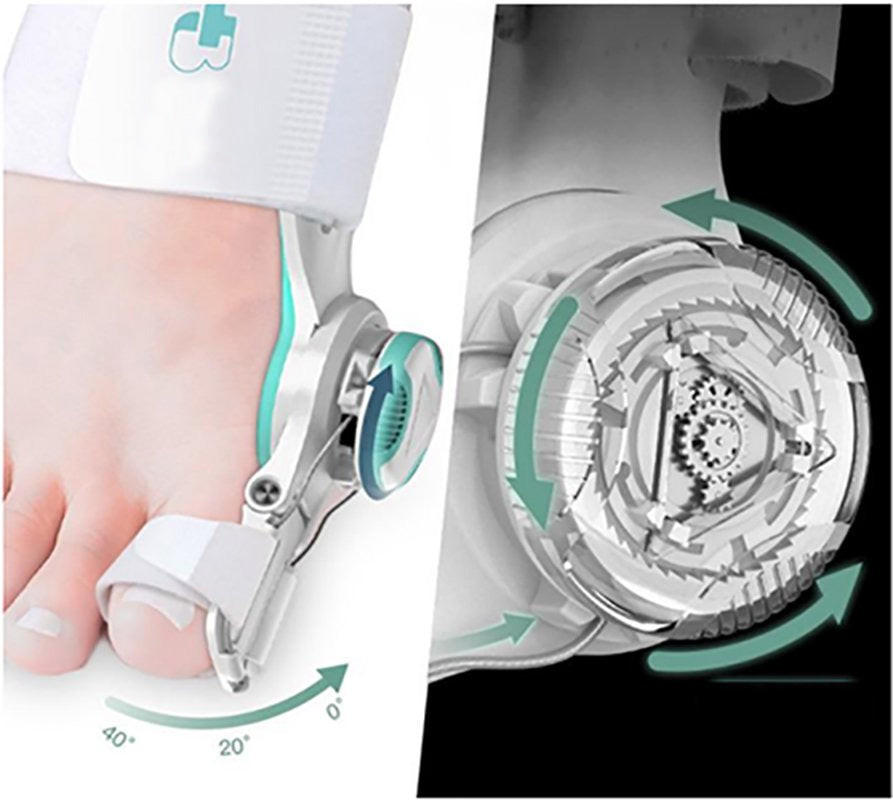 Correcteur Hallux Valgus Efficace - MediCare™