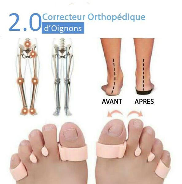 Correcteur Orthopédique d'Oignons