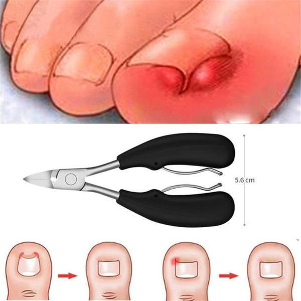 Coupe-ongles pour ongles incarnés