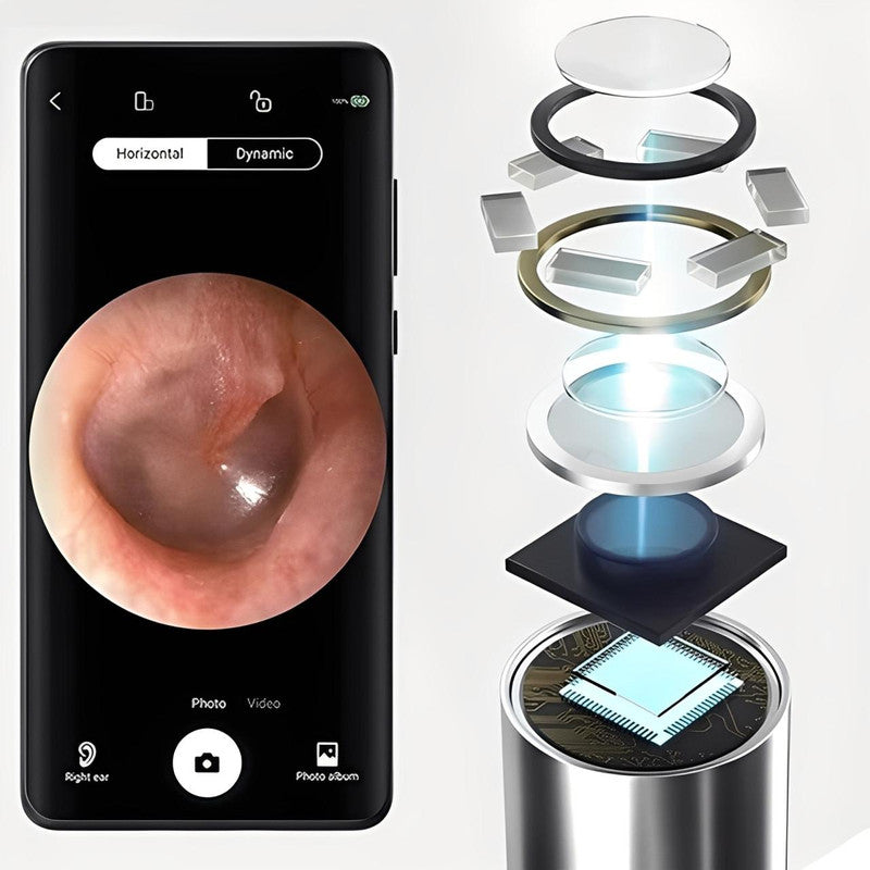 Cure Oreille Avec Caméra Réutilisable