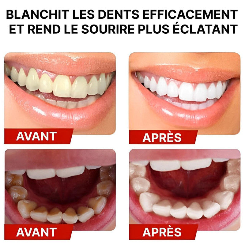 Dentifrice Violet Blanchissant - HealthCare™