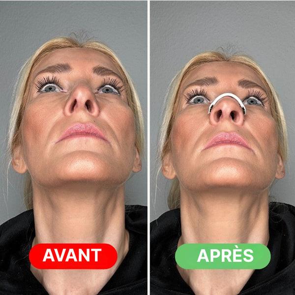 Écarteur Nasal Magnétique Pour Le Sport Et Ronflement