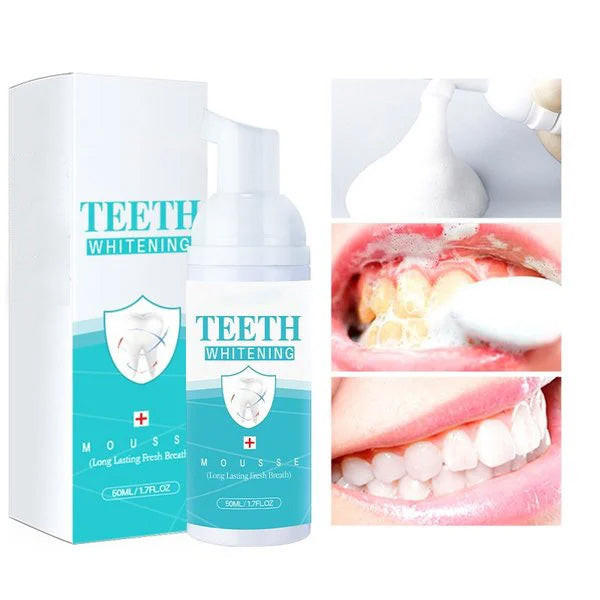 Mousse Blanchiment Dentaire - WhiteCare™