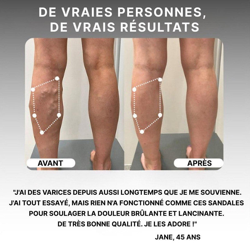 Sandales De Réflexologie Plantaire Et Acupression