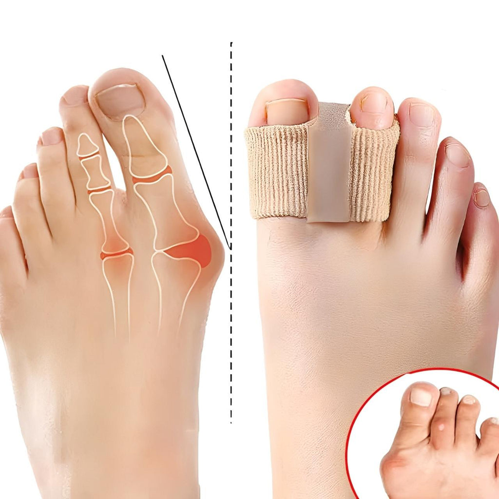 Séparateur d'Orteils Correcteur Hallux Valgus (lot de 2)