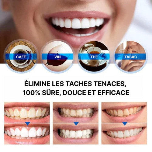 Stylo Blancheur Dent - HealthCare™