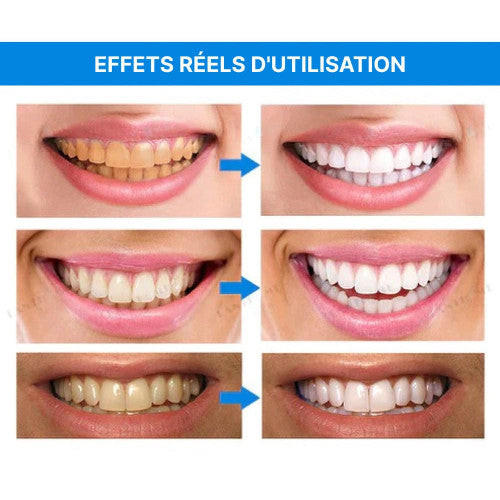 Stylo Blancheur Dent - HealthCare™